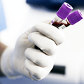Image of collection tubes for immunoassay testing